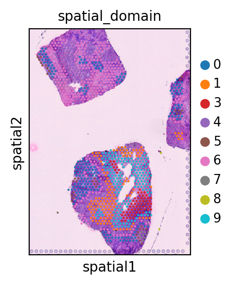 ../_images/tutorials_Visium_human_breast_cancer_Splane_21_3.png