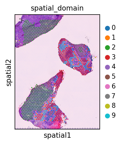 ../_images/tutorials_Visium_human_breast_cancer_Splane_21_5.png